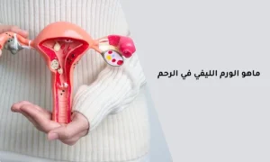 أفضل دكتور أشعة تداخلية | الأشعة التداخلية | مركز الأشعة التداخلية