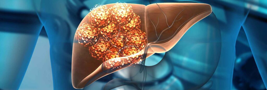 685e6eb818ff1 1 د. أحمد سعفان | أول مركز متخصص في الأشعة التداخلية في الدلتا