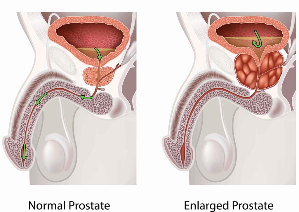 Untitled 1 1 د. أحمد سعفان | أول مركز متخصص في الأشعة التداخلية في الدلتا