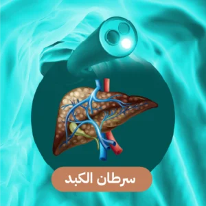 أفضل دكتور أشعة تداخلية | الأشعة التداخلية | مركز الأشعة التداخلية