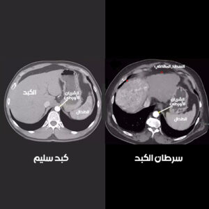 أفضل دكتور أشعة تداخلية | الأشعة التداخلية | مركز الأشعة التداخلية